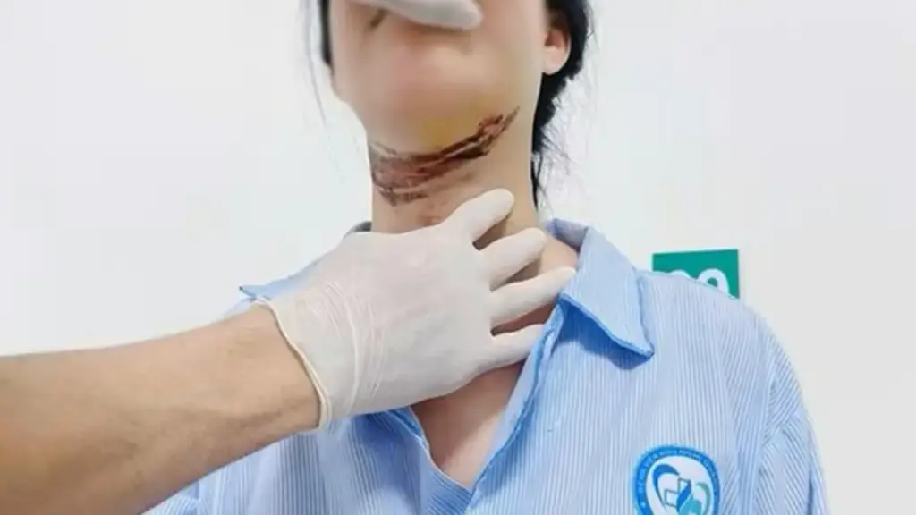 Nữ sinh ở Quảng Trị bị dây giăng ngang đường cứa vào cổ khi đi học về