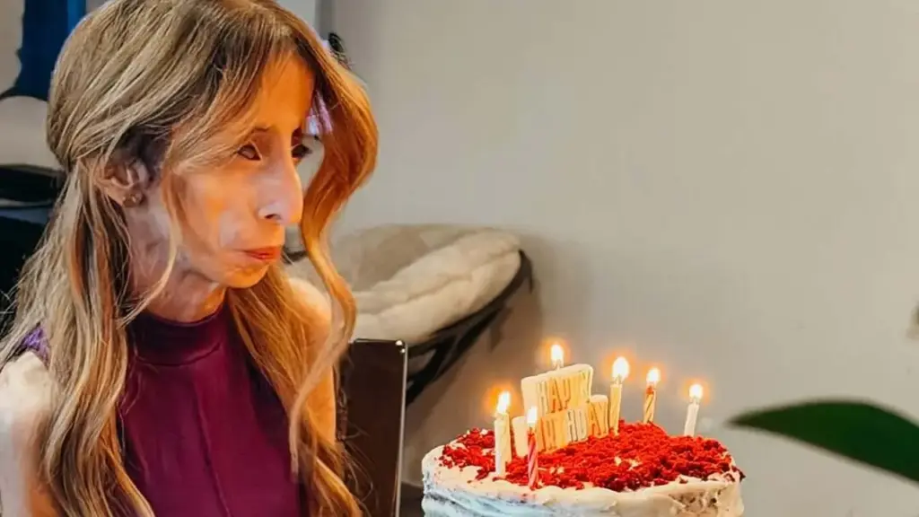 Sự lột xác của 'người phụ nữ xấu nhất thế giới'